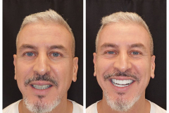 WhatsApp-Gorsel-2024-03-16-saat-10.16.00_20a053a6