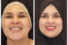 WhatsApp-Gorsel-2024-03-16-saat-10.16.00_44038792