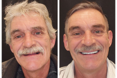 WhatsApp-Gorsel-2024-03-16-saat-10.16.01_66f2ba17