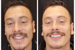 WhatsApp-Gorsel-2024-03-16-saat-10.16.01_ac51158d