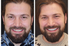 WhatsApp-Gorsel-2024-03-16-saat-10.16.01_cd39c7d7