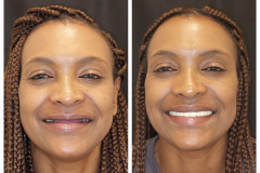 WhatsApp-Gorsel-2024-03-16-saat-10.16.02_105f8f38