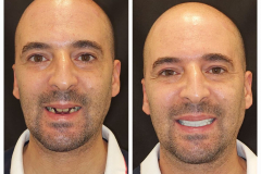 WhatsApp-Gorsel-2024-03-16-saat-10.16.02_bb371da1