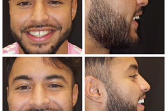 WhatsApp-Gorsel-2024-03-16-saat-10.16.02_e7f4c618