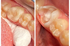 WhatsApp-Gorsel-2024-03-16-saat-10.16.02_f928c717