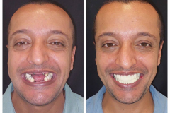 WhatsApp-Gorsel-2024-03-16-saat-10.16.03_4c908311