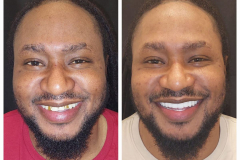 WhatsApp-Gorsel-2024-03-16-saat-10.16.03_8e0dce4c