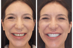 WhatsApp-Gorsel-2024-03-16-saat-10.16.04_8b065ff3