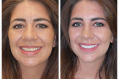 WhatsApp-Gorsel-2024-03-16-saat-10.16.04_bd968ccc