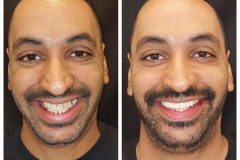 WhatsApp-Gorsel-2024-03-16-saat-10.16.04_c0d49ccc