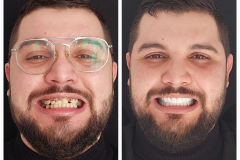 WhatsApp-Gorsel-2024-03-16-saat-10.16.04_ee62b49b