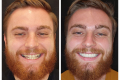 WhatsApp-Gorsel-2024-03-16-saat-10.16.05_2bff6673