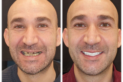 WhatsApp-Gorsel-2024-03-16-saat-10.16.05_3ac06750