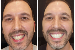 WhatsApp-Gorsel-2024-03-16-saat-10.16.05_81c8199b