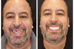 WhatsApp-Gorsel-2024-03-16-saat-10.16.05_bf399fa8