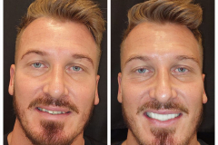 WhatsApp-Gorsel-2024-03-16-saat-10.16.05_d059be6b