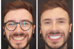 WhatsApp-Gorsel-2024-03-16-saat-10.16.06_1229ccd7