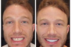 WhatsApp-Gorsel-2024-03-16-saat-10.16.06_28fafd41