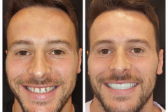 WhatsApp-Gorsel-2024-03-16-saat-10.16.06_4a1a29a1