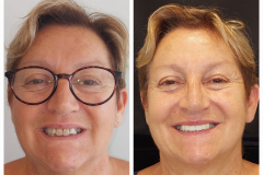 WhatsApp-Gorsel-2024-03-16-saat-10.16.06_66196d24