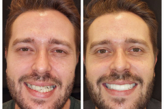 WhatsApp-Gorsel-2024-03-16-saat-10.16.07_043d105b