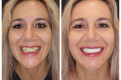 WhatsApp-Gorsel-2024-03-16-saat-10.16.07_0c998da7