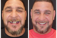 WhatsApp-Gorsel-2024-03-16-saat-10.16.07_dcd088fa