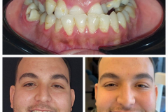 WhatsApp-Gorsel-2024-03-16-saat-10.16.08_6d805c36