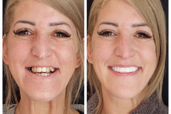 WhatsApp-Gorsel-2024-03-16-saat-10.16.08_a24bcb90