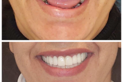 WhatsApp-Gorsel-2024-03-16-saat-10.16.08_dcad039e