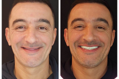 WhatsApp-Gorsel-2024-03-16-saat-10.16.09_32a25575