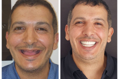 WhatsApp-Gorsel-2024-03-16-saat-10.16.09_6df5144b