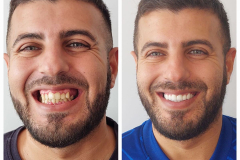 WhatsApp-Gorsel-2024-03-16-saat-10.16.09_b83282ca