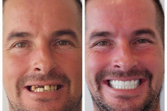 WhatsApp-Gorsel-2024-03-16-saat-10.16.09_e96826af