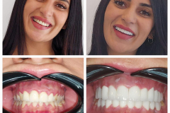 WhatsApp-Gorsel-2024-03-16-saat-10.16.10_236303fd