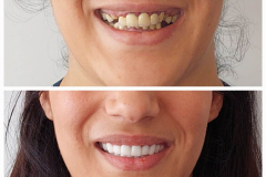 WhatsApp-Gorsel-2024-03-16-saat-10.16.10_29883400