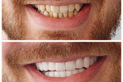 WhatsApp-Gorsel-2024-03-16-saat-10.16.10_853b984c