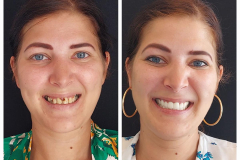 WhatsApp-Gorsel-2024-03-16-saat-10.16.10_adbd35ad