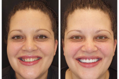 WhatsApp-Gorsel-2024-03-16-saat-10.16.32_742c0be4