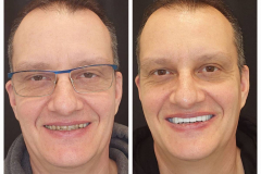 WhatsApp-Gorsel-2024-03-16-saat-10.16.32_9c3a13f6