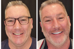 WhatsApp-Gorsel-2024-03-16-saat-10.16.32_c58135d7