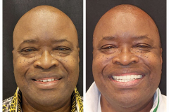 WhatsApp-Gorsel-2024-03-16-saat-10.16.33_4a4d7523