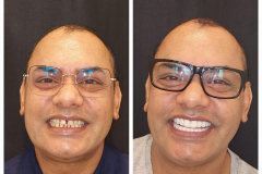 WhatsApp-Gorsel-2024-03-16-saat-10.16.33_7d317608