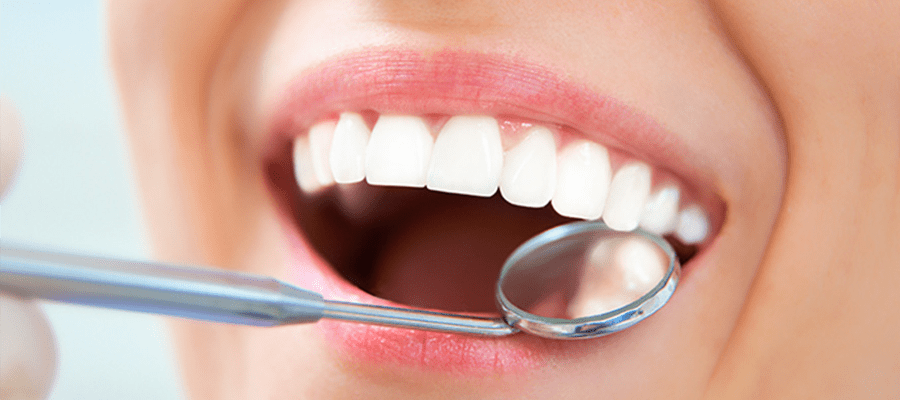 lingual ortodontik tedavi