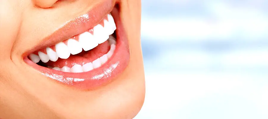 diş beyazlatma