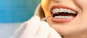 Orthodontics Mecidiyeköy orthodontics