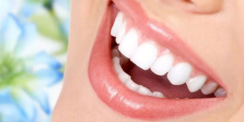 Nişantaşı Pembe Diş Estetiği