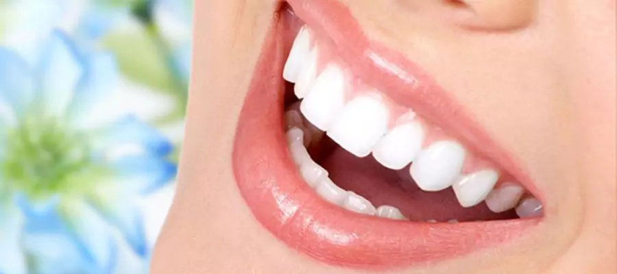 hollywood smile nedir