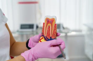 Root Canal Treatment A dentist with pink gloves shows the canal structure on a detailed tooth model with a metal instrument.