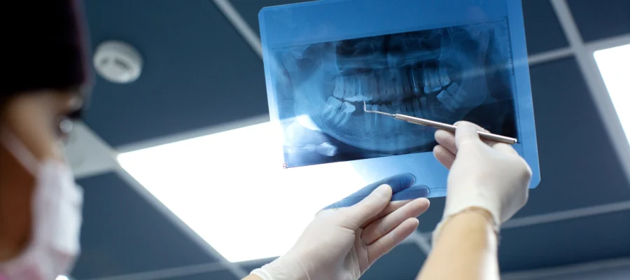 Diş hekimi tomografi filmi üzerinde çürük analizi yapıyor – Mecidiyeköy diş tomografisi